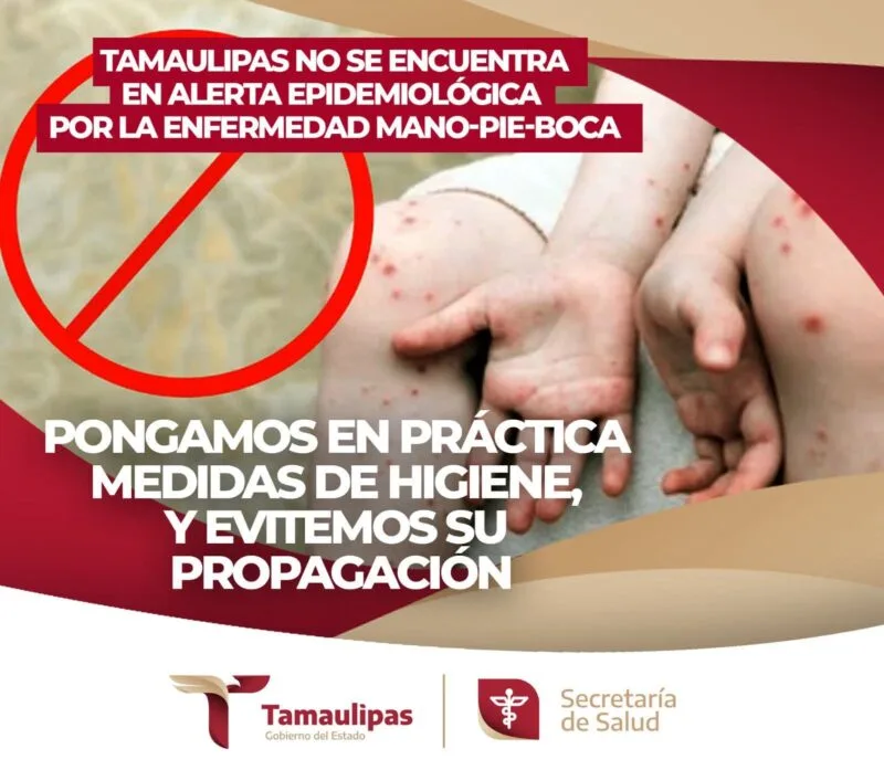 Difunde SET medidas sobre el virus boca-mano-pie entre la comunidad educativa